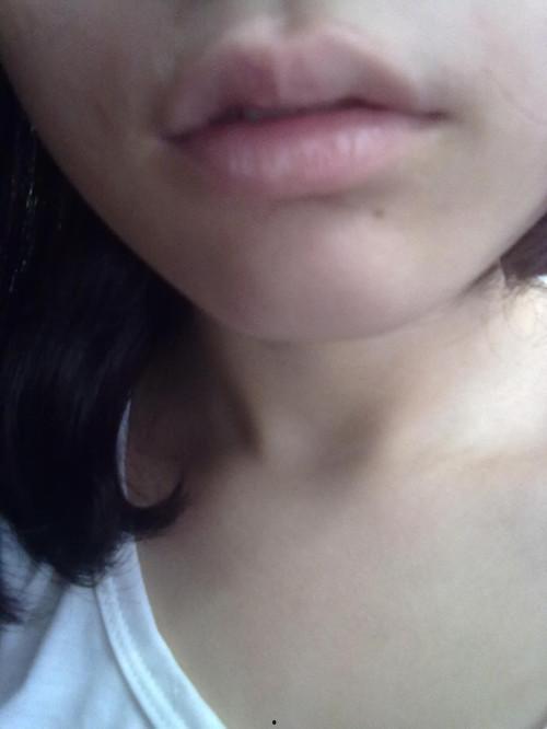 吃蜜瓜后嘴唇痒,揭秘吃蜜瓜后嘴唇痒的神秘现象